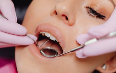 The Importance of Regular Dental Cleanings for Optimal Oral Health