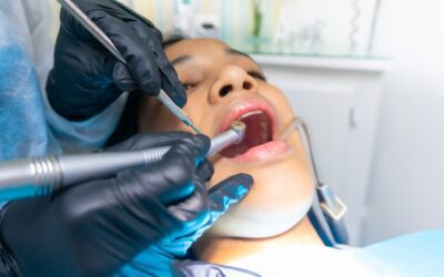 How Dental Fillings Can Save Your Teeth: A Comprehensive Guide