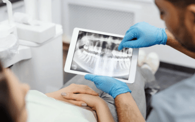 Root Canals: Debunking Myths and Explaining the Process