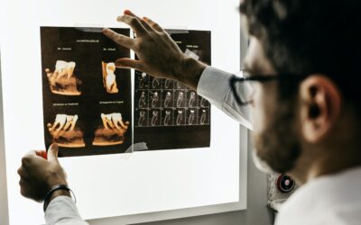 The Vital Role of X-Rays in Dental Care